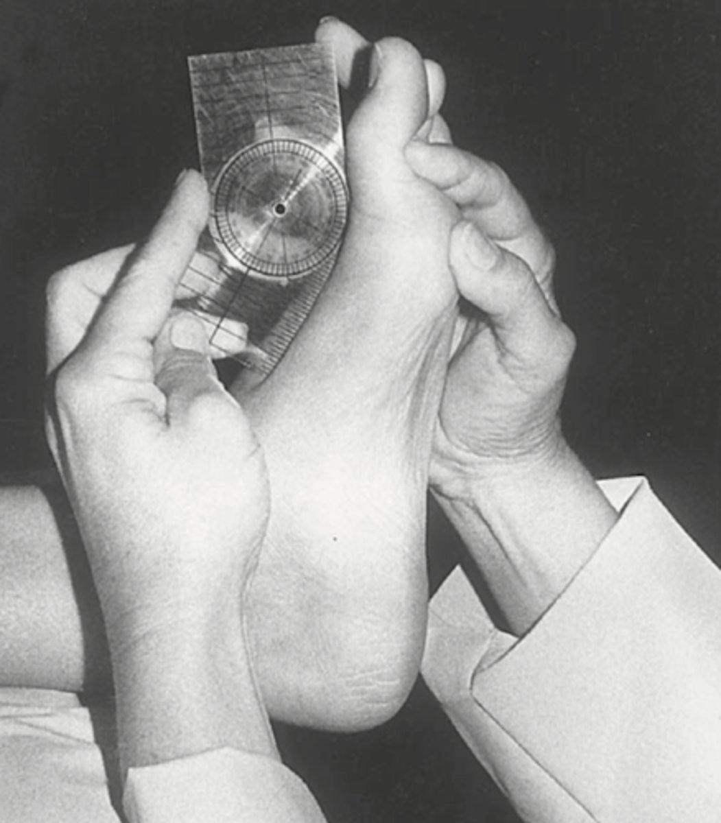 <p>MTP1: 70</p><p>MTP2-5: 40</p>