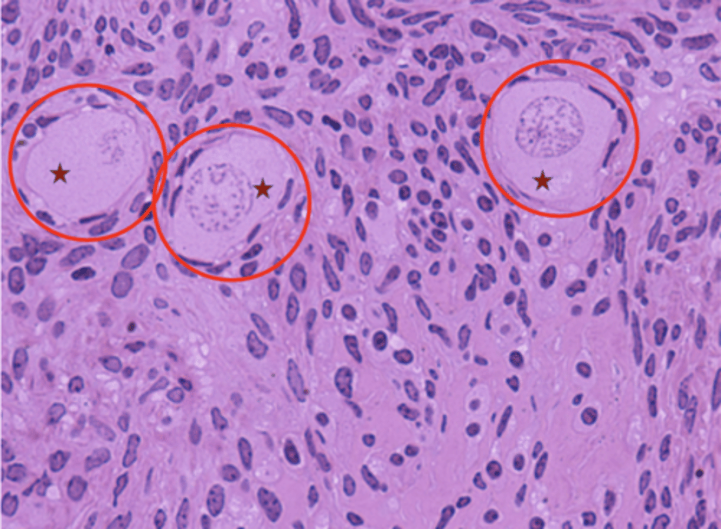 <p>What is the red star?</p>