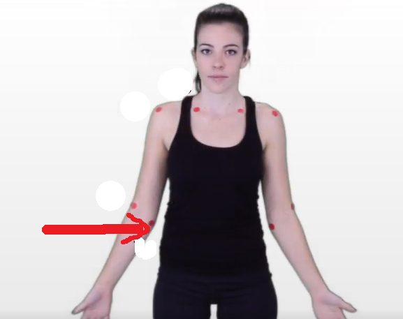 <p>The dermatomal area where the arrow is pointing would indicate what level? </p>