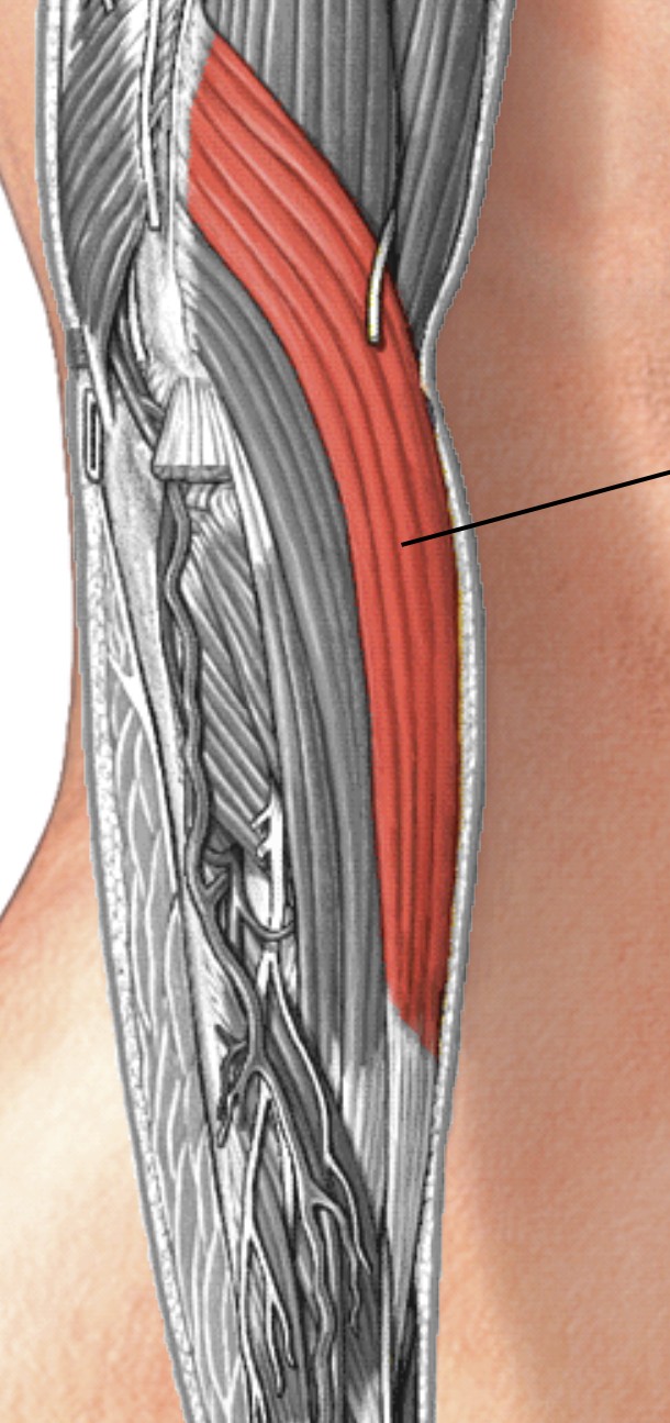 <p>Which muscle of the forearm is:</p><ul><li><p>Lateral side of forearm, wraps from back of humerus to front of radius</p></li><li><p>Action: flex elbow</p></li><li><p>Nerve: radial</p></li></ul><p></p>