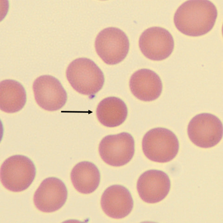 <p>What is the shape of this erythrocyte?</p>