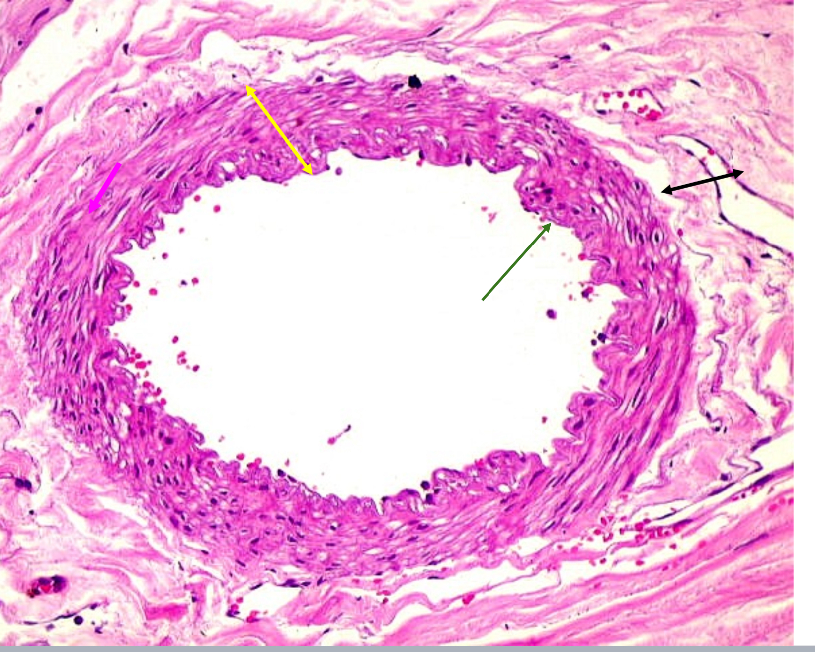 <p>Artery or vein?</p>