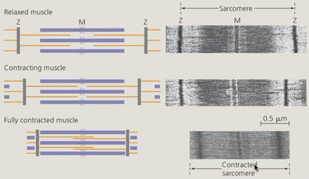 <p>1) fully contracted muscle</p><p>2) contracting muscle</p><p>3) relaxed muscle</p>