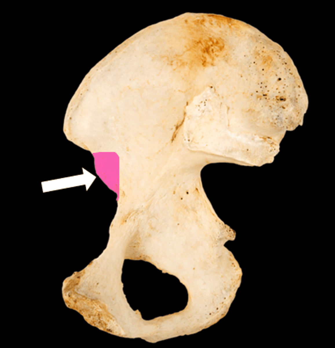 <p>name the part</p>