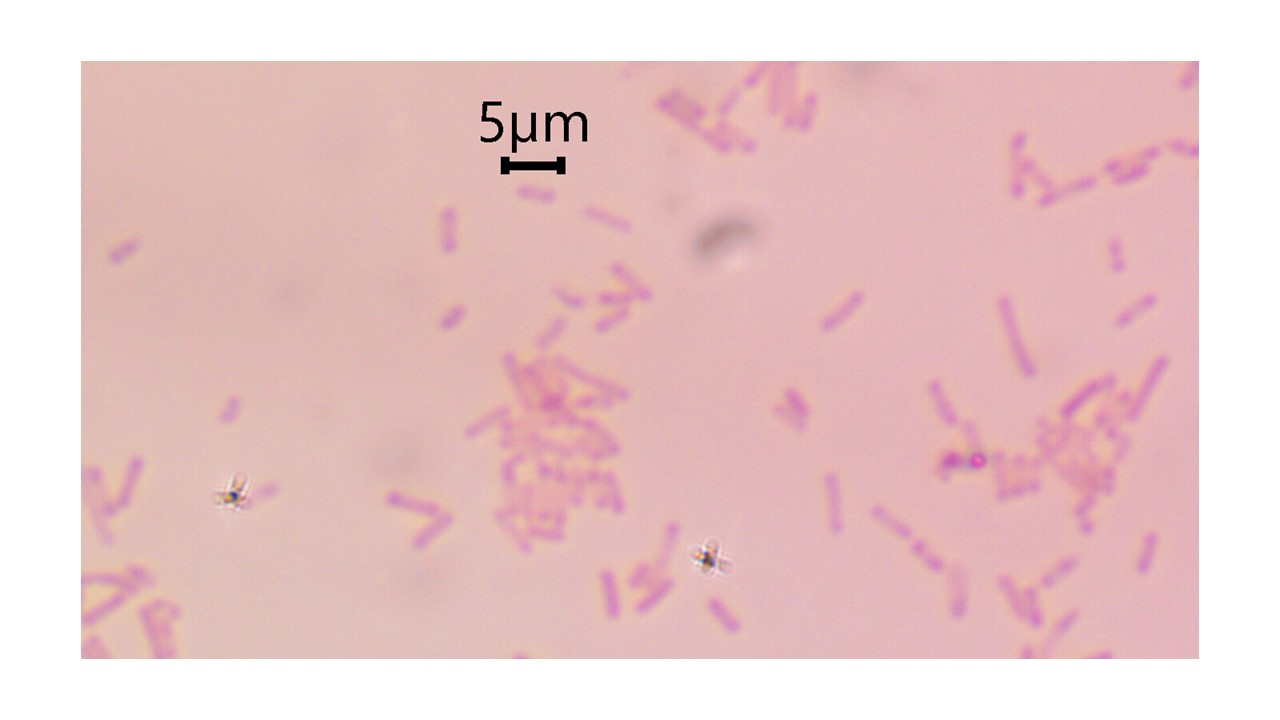 <p>w<span>hich type of cell wall (Gram negative or Gram positive) was Pseudomonas aeruginosa</span></p>