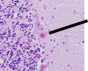 <p>Name Cell Type and its Function/Name Type of Neuron and its Function</p>