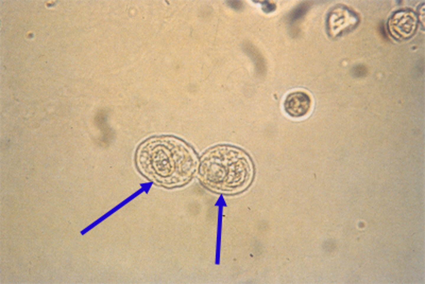 <p>small traces are normal, Increased amounts indicate renal disease</p>