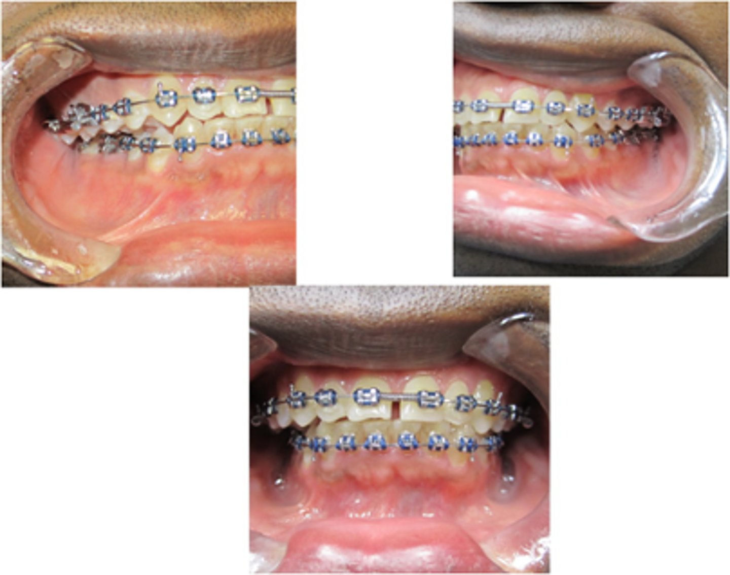 <p>ID the discrepancy:</p>