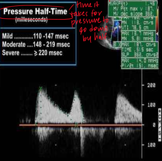 <p>time it takes for pressure to go down by half&nbsp;</p><p>trace waveform&nbsp;</p>