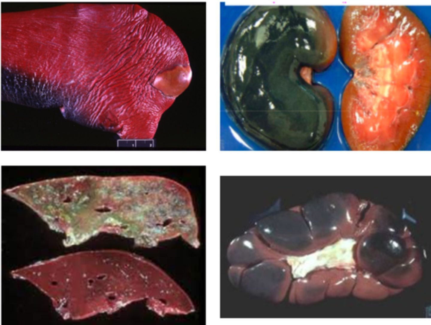 <p>- Blue-green staining of tissues due to Iron Sulfide (H2S + Fe) as a result of bacteria acting on blood breakdown products</p><p>- Frequent on the liver, and is different from bile imbibition because it is located where the liver touches the GI tract</p>