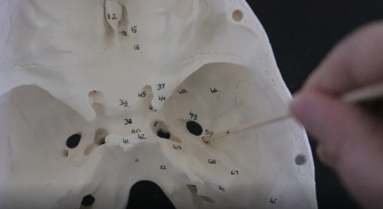 <p>hole in the sphenoid bone that allows nerves &amp; arteries pass through</p>