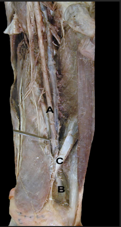 <p>Identify the structures from this<strong> Medial View</strong> of the thigh’s Femoral Artery&nbsp;</p>