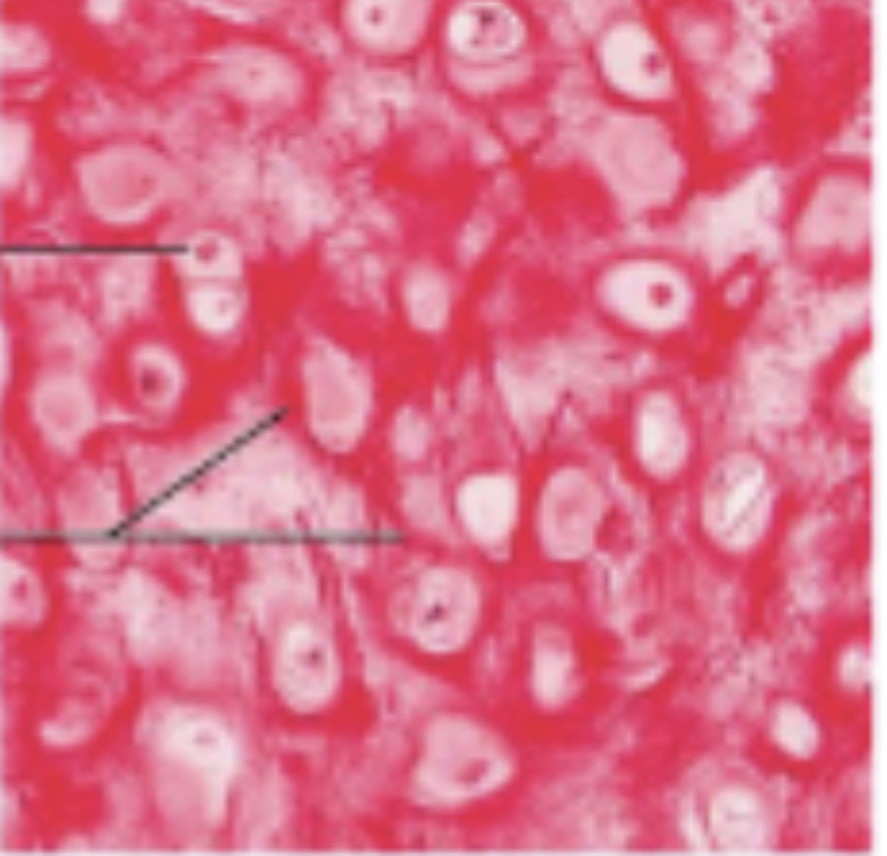 <p>cartilage with abundant elastic fibers; more flexible than hyaline cartilage</p>