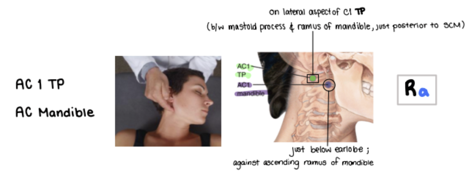<p>Just a bit superior and lateral to AC2, which lies on the ascending ramus of mandible.</p><ul><li><p>Patient lying on back and ONLY <strong>Rotate away</strong></p></li></ul><p></p>