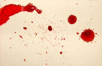 <p>smaller bloodstain that originated during the formation of the parent stain as a result of blood impacting a surface</p>