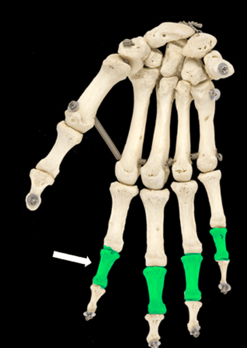 <p>name the part</p>