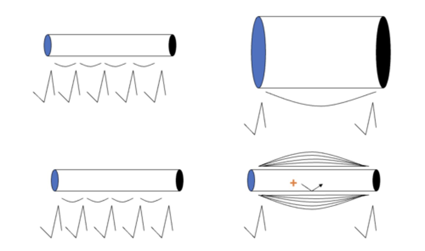 <p>decreased speed as a brief pause must occur while the sodium channels open;</p><p>1. increase the diameter of the axon</p><p>2. myelination</p>
