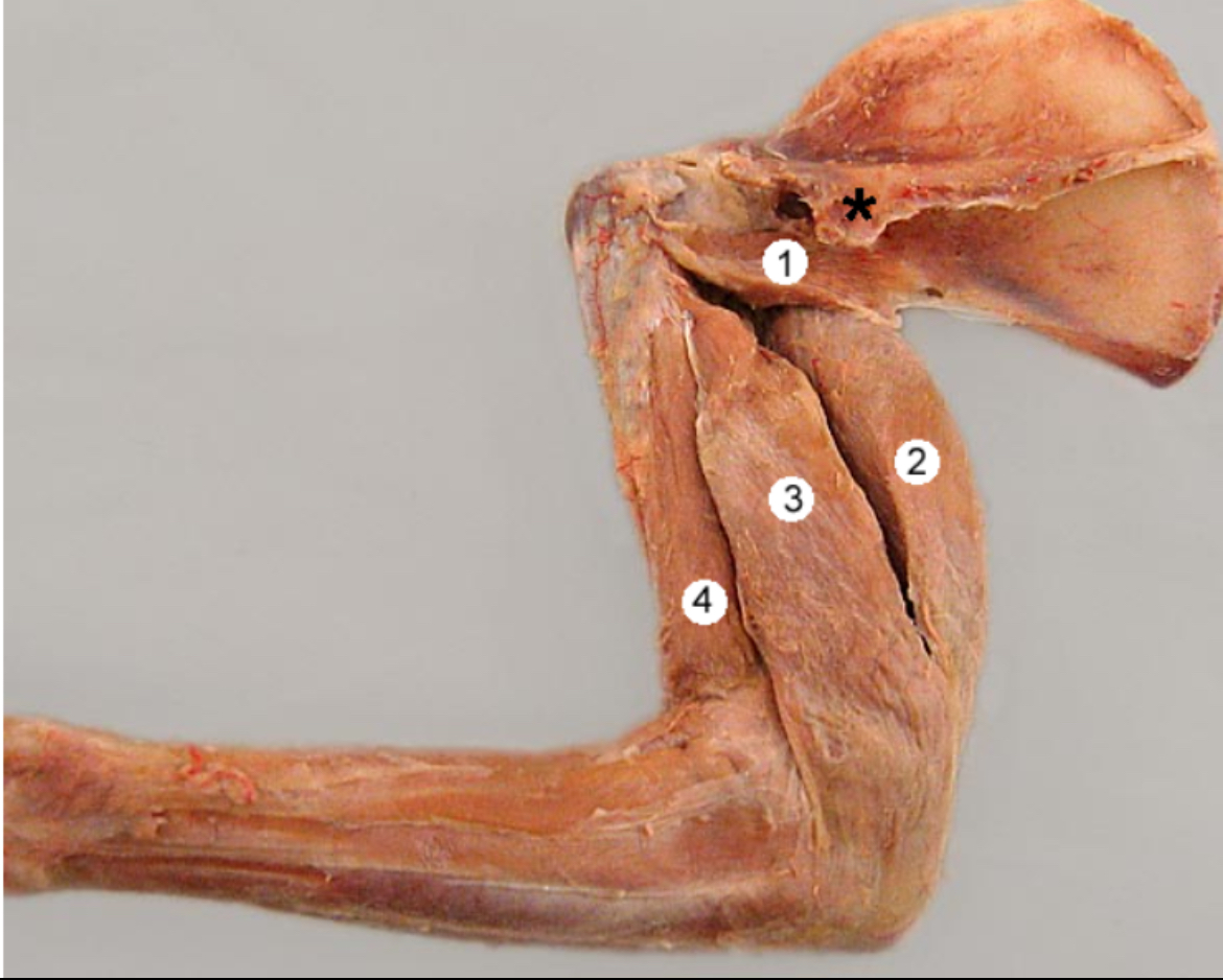<p>Triceps brachii m. #3</p>