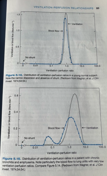 <p>Can obtain information about the distribution of ventilation-perfusion ratios in patients with lung disease by infusing a mixture of dissolved inert gases with a range of solubilities into a peripheral vein and then measuring the concentrations of the gases in arterial blood and expired gas</p><ul><li><p><span>Figure 5.14 shows the results from a healthy individual</span></p><ul><li><p><span>All the ventilation and blood flow goes to compartments close to the normal ventilation-perfusion ratio of about 1.0 and there is no blood flow to the unventilated compartment (shunt)</span></p></li></ul></li><li><p><span>Figure 5.15 shoes a patient with chronic bronchitis and emphysema</span></p><ul><li><p><span>Much of the ventilation and blood flow goes to compartments with ventilation-perfusion ratios near normal, considerable blood flow is going to compartments with&nbsp; ventilation-perfusion ratios of between 0.03 and 0.3</span></p><ul><li><p><span>Blood from these units is poorly oxygenated and will depress the arterial PO2</span></p></li></ul></li><li><p><span>There is also excessive ventilation to lung units with ventilation-perfusion ratios up to 10</span></p><ul><li><p><span>These units are inefficient at eliminating CO2</span></p></li></ul></li></ul></li></ul><p></p>