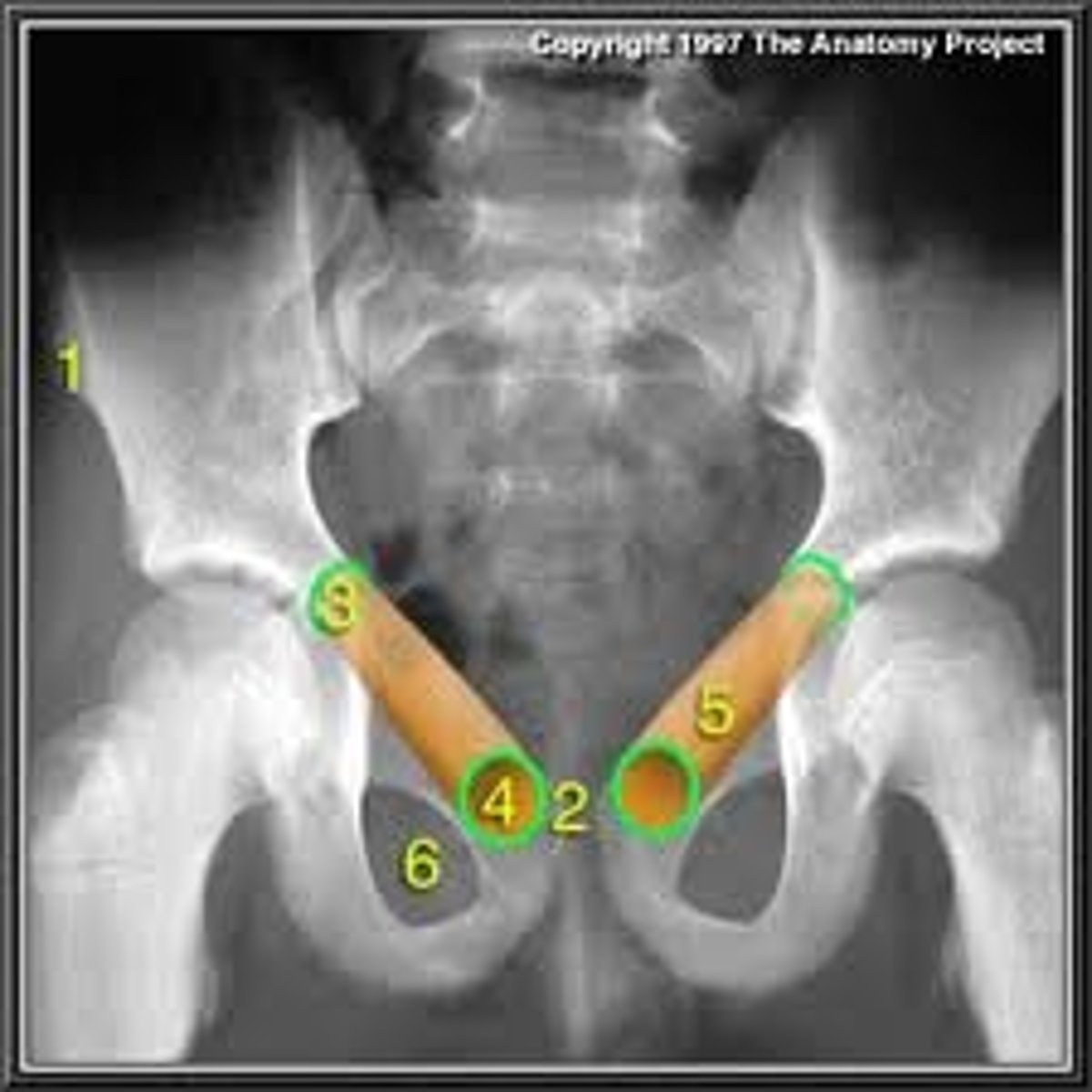 <p>Groin</p>