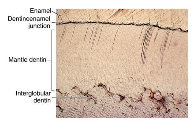 <p><span style="background-color: transparent;"><span>området precis under manteldentinet där mineraliseringen inte fullbordats (ofullständig mineralisering).</span></span></p>