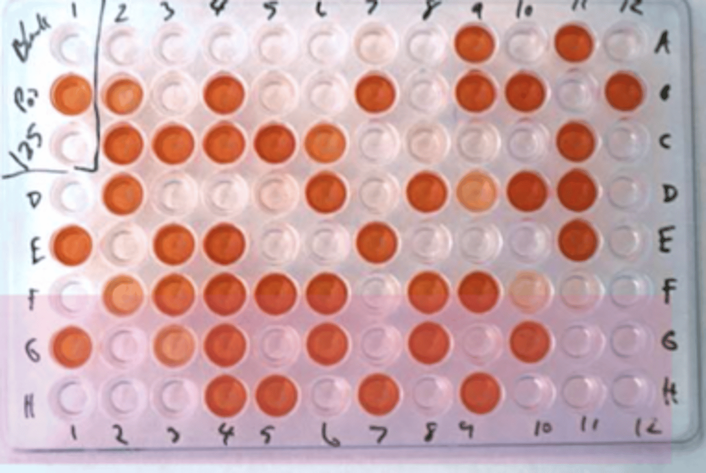<p>elección: serológico- IDGA, ELISA (western blood prueba de confirmación)</p><p>- improbable que todo un rebaño sea seronegativo, pq es muy común</p><p>- pero ser seronegativo también significa que NO tiene inmunidad. </p><p>- más frecuente que hay animales positivos</p><p>es difícil:</p><p>- signos inespecíficos</p><p>- curso lento</p><p>- lesiones macroscopicas solo evidentes al final</p><p>- histopatología es orientativa, pero no específica</p>