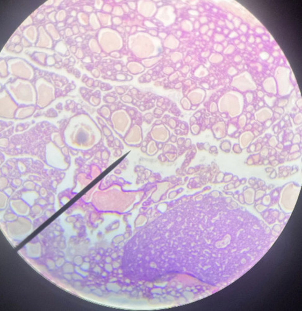 <p>what hormone does this gland secrete?</p>