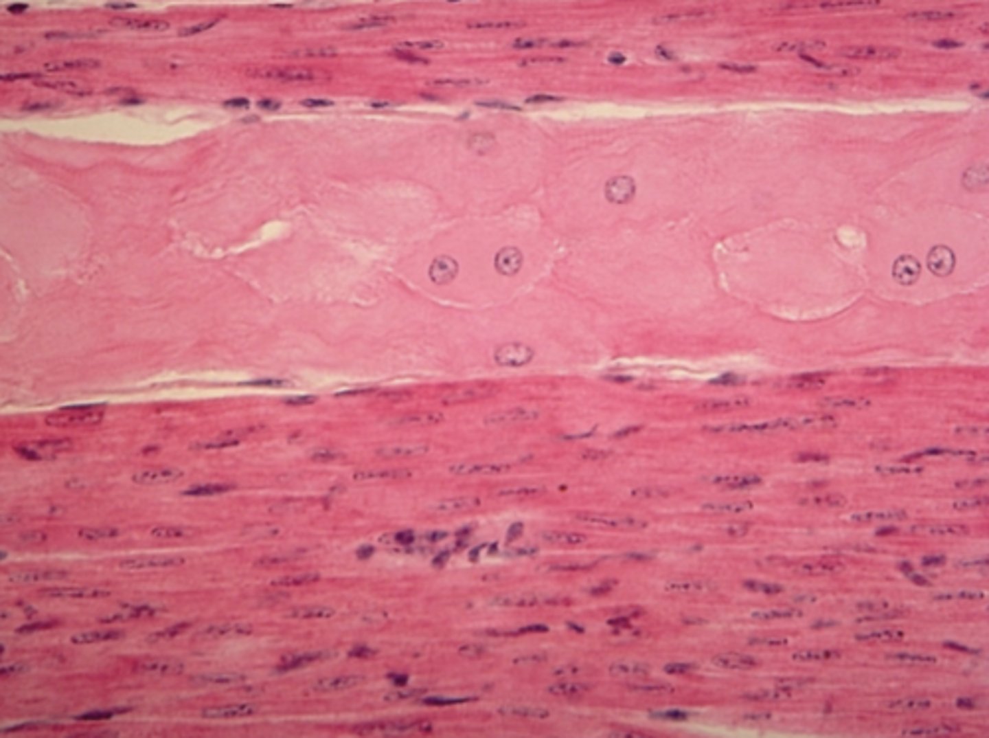 <p>Which of the four major tissue types is presented in the following image of the heart:</p>