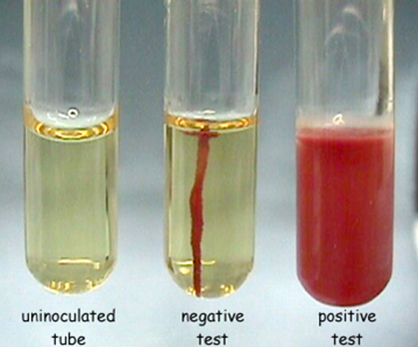 <p>Test that determines whether or not a bacteria has flagella so that it can move in water-based environments</p>