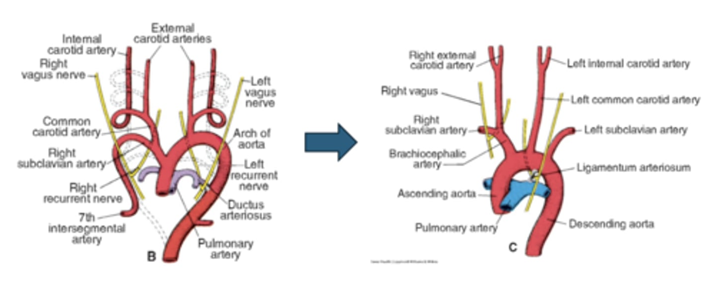 <p>Right distal 6th arch regresses; nerve recurs around right subclavian artery</p>