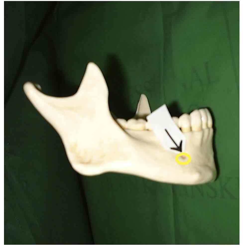term image