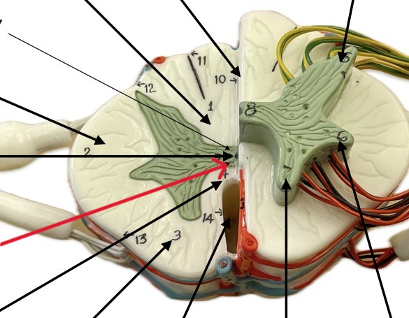 <p>Which gray commissure of the spinal cord is:</p><ul><li><p>Gray and on anterior side</p></li><li><p>Anterior to the central canal</p></li></ul><p></p>