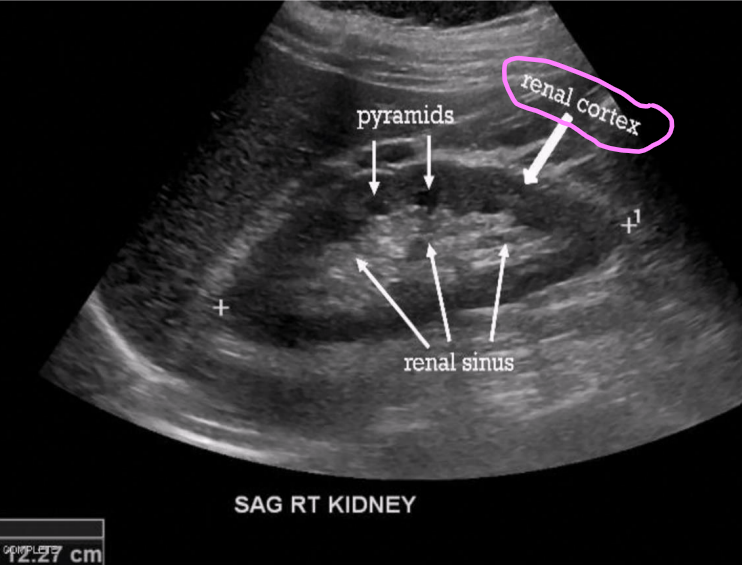 <ul><li><p>Outermost area of kidney</p></li><li><p>Lies just beneath renal capsule </p></li><li><p>Area in which urine is produced </p></li><li><p>Some cortical tissues extends between medullary pyramids (columns of Bertin)</p></li></ul><p></p>