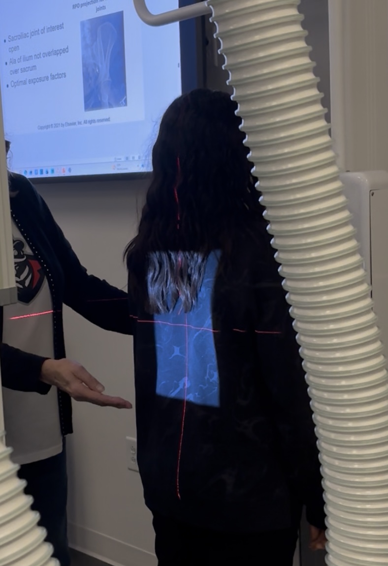 <p>Scoliosis- PA</p>