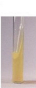 <p>Urea results</p>