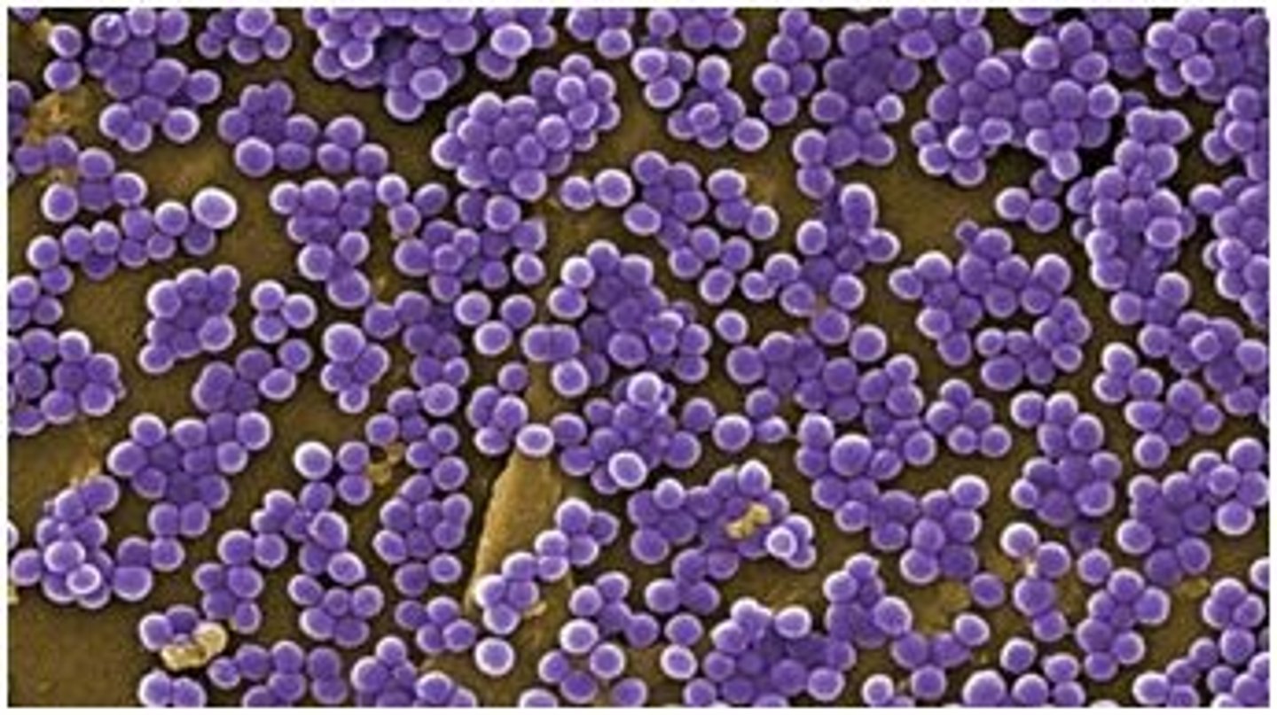 <p>grape like clusters</p>