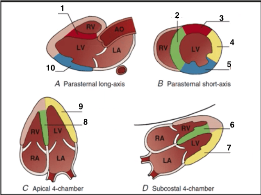 <p><span><span>Match the numbers with the corresponding LV walls: </span></span></p>
