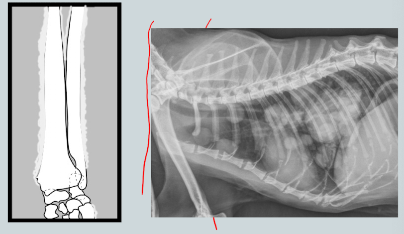 <p>________________: neoplastic sydrome of unknown etiology affecting middle-older dogs. Will see periosteal reaction of digits/long bones associated with neoplastic or infectious lung disease. Distal limbs. </p>
