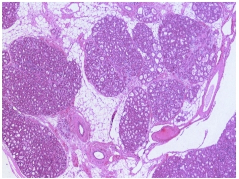 <p>Identify then define </p>