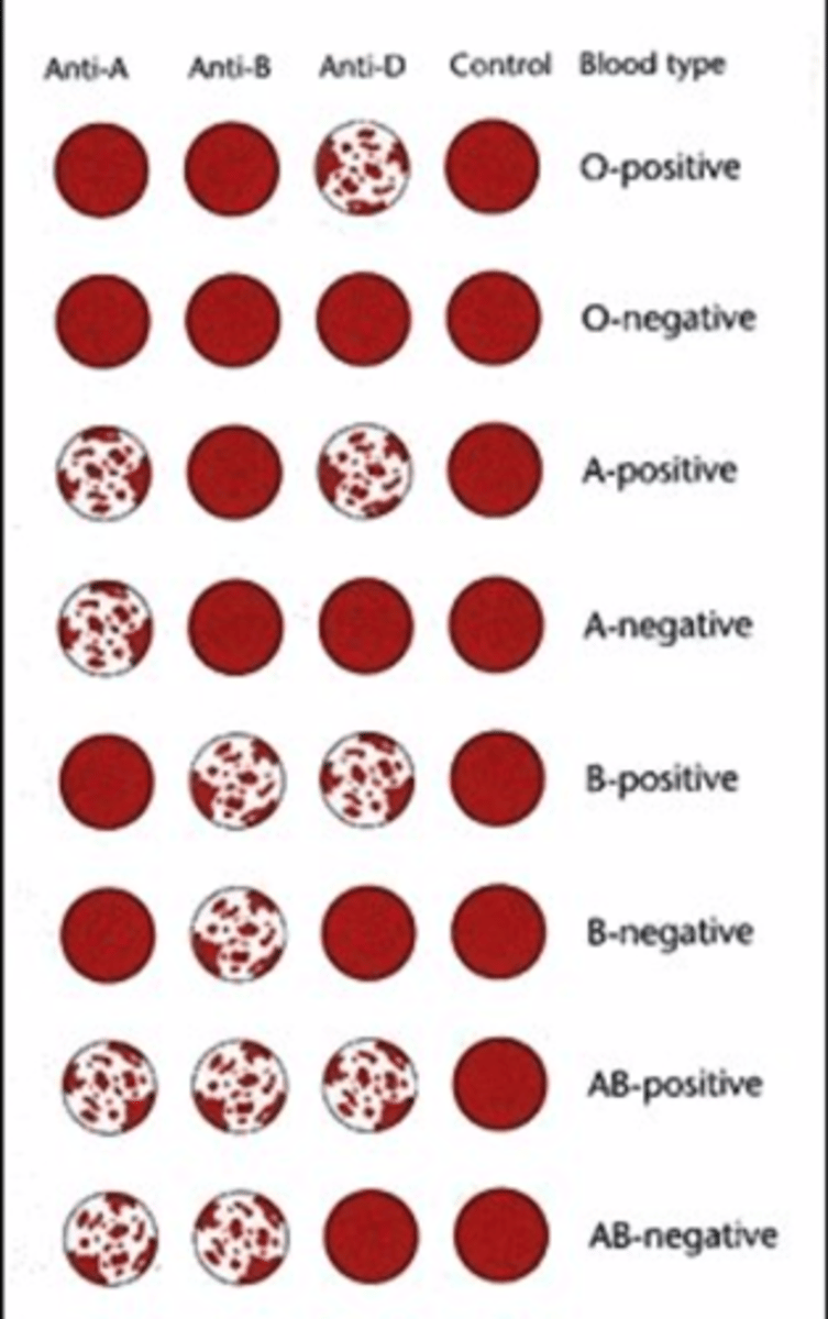<p>Antigens (Neither), Antibodies (Both).</p>