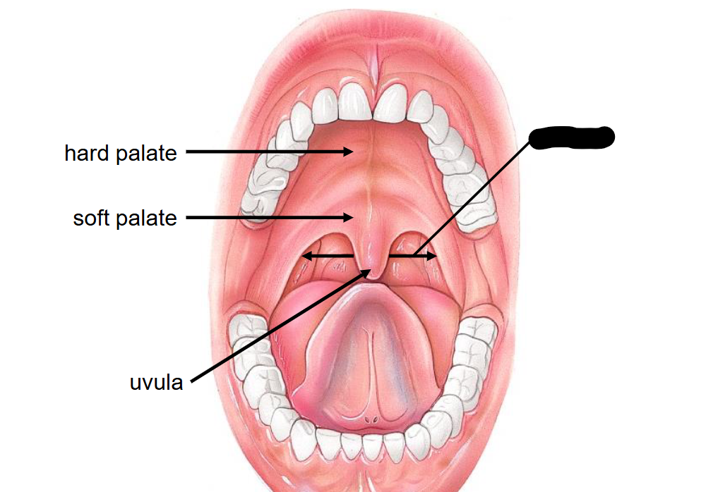 <p>What structure is this within the Mouth?</p>
