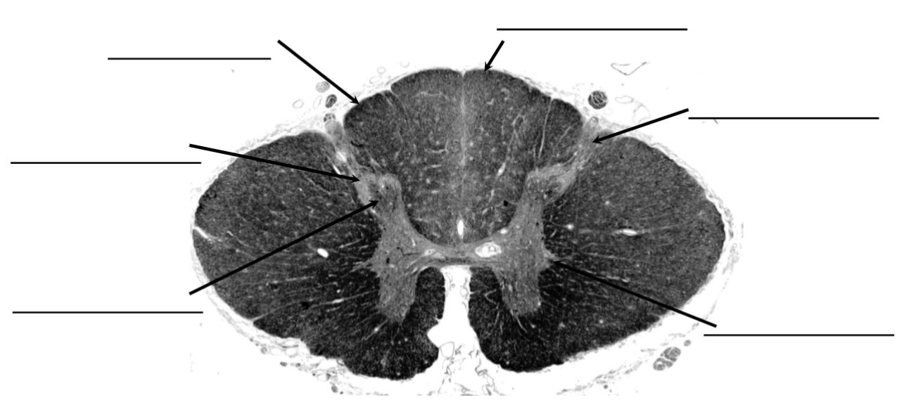 <p>identify this spinal level</p>