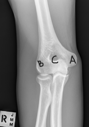 <p>What are A, B, and C in this image?</p>