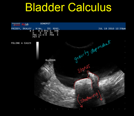 <p>Bladder Disease on Ultrasound</p>