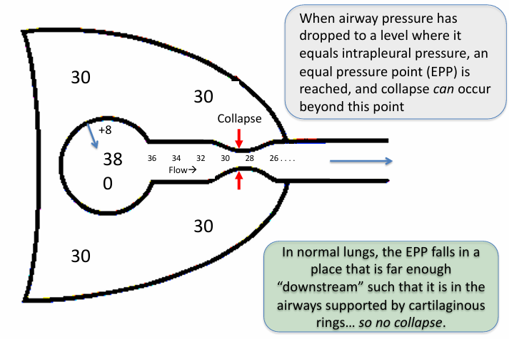 <p>-in diseases that increase airway resistance: friction loss is greater, pressure drop is steeper, EPP falls further upstream</p>