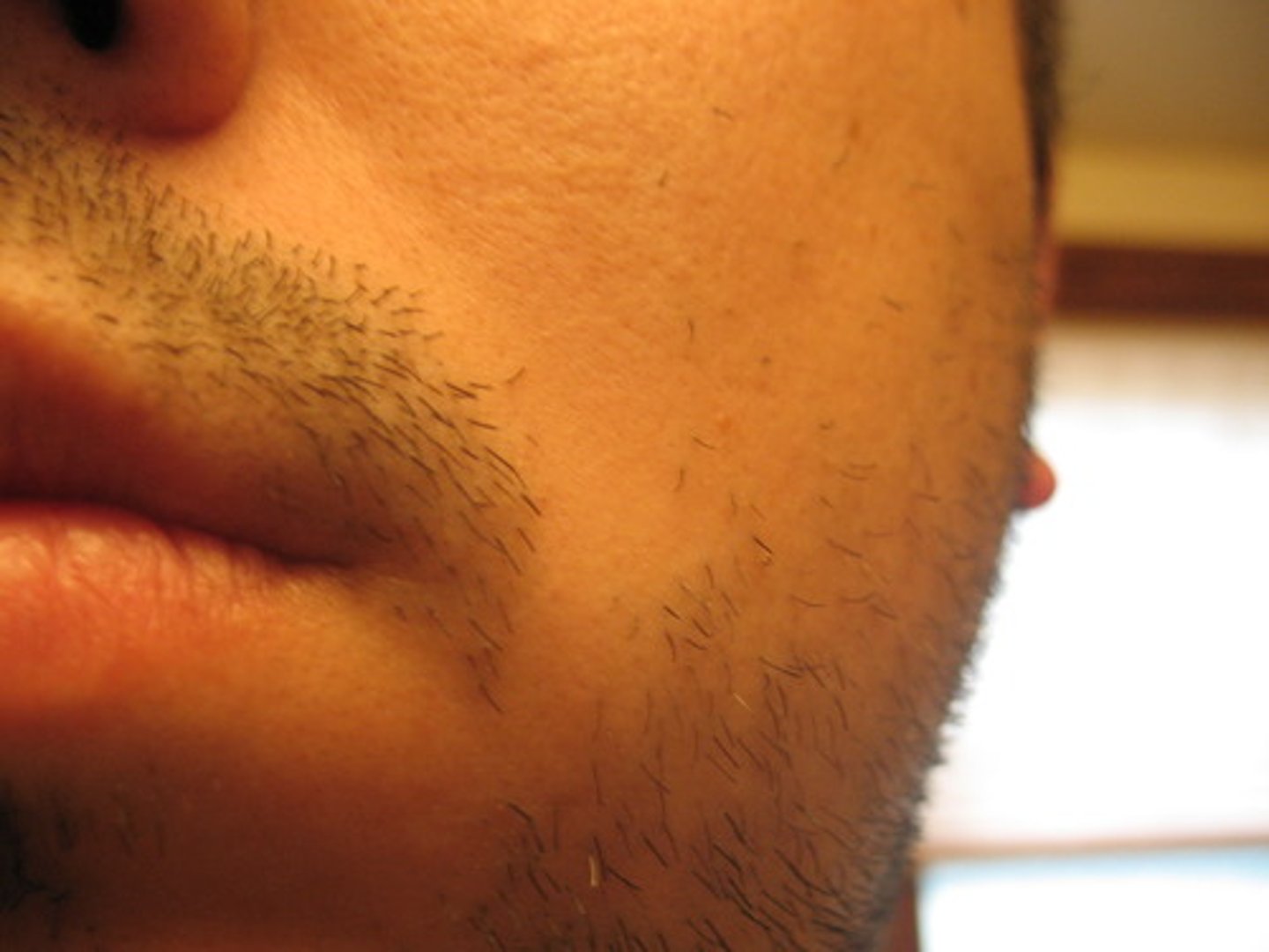 <p>the number of individual hair strands on 1 square inch (2.5 square centimeters) of scalp</p>