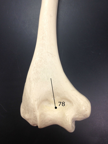 <p>Identify if this is an anterior or posterior view and if it is a right or left.</p>