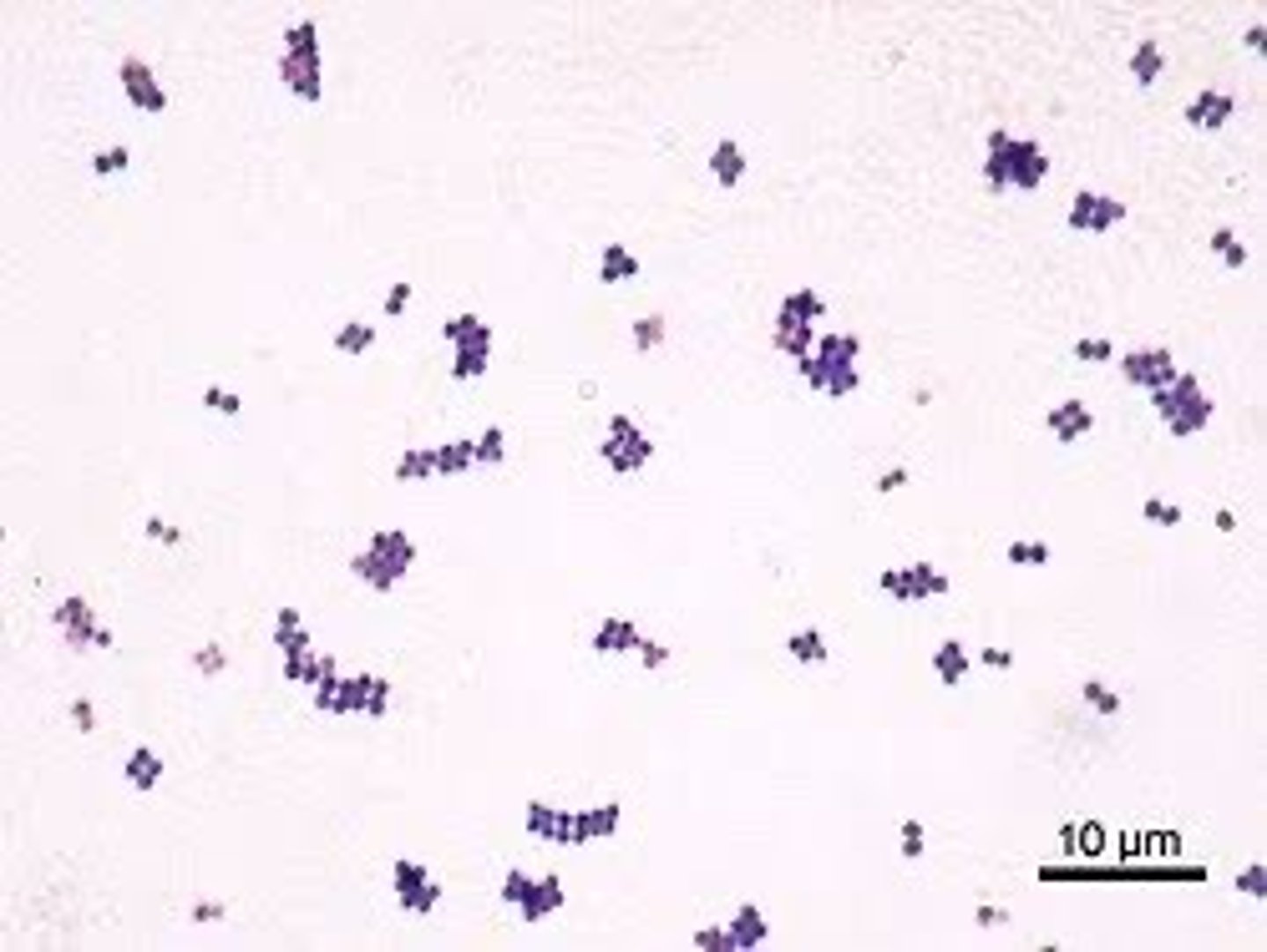 <p>GPC, catalase pos, arranged in clusters</p>