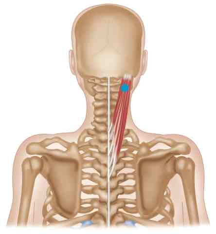 <p>Splenius <strong>ORIGIN</strong></p>