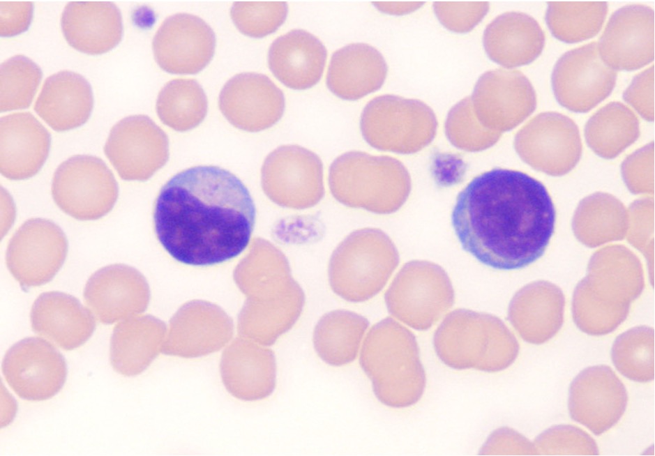 <p>Consisting of B-cells and T-cells. Maturation occurs in Bone marrow &amp; Thymus.</p><p>B-lymphocyte terminal differentiation results in plasma cells.</p>